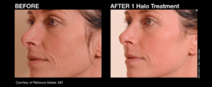 halo_before_and_afters_5_final
